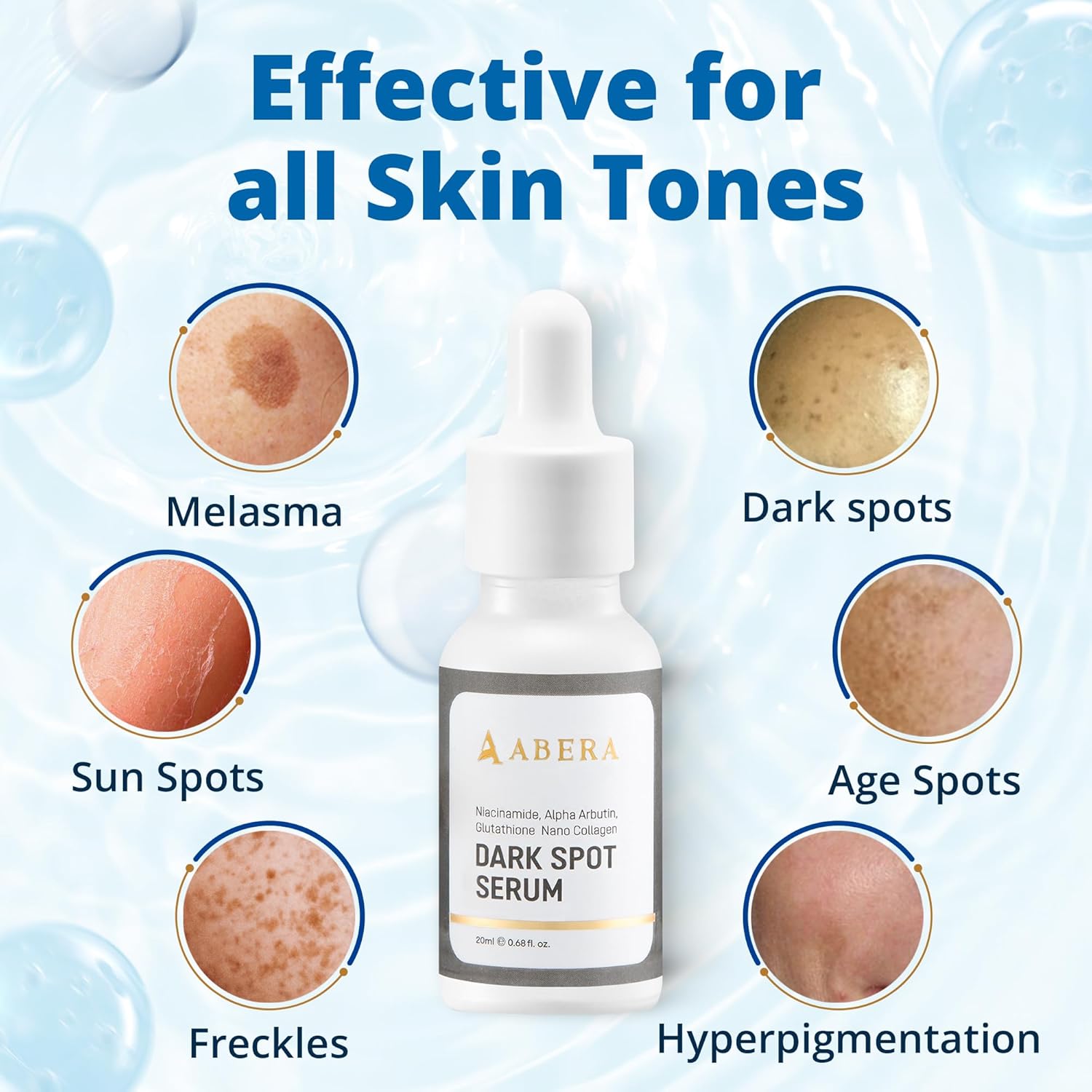 Abera Dark Spot Serum - Brighten Skin Fast - ABERA SHOP