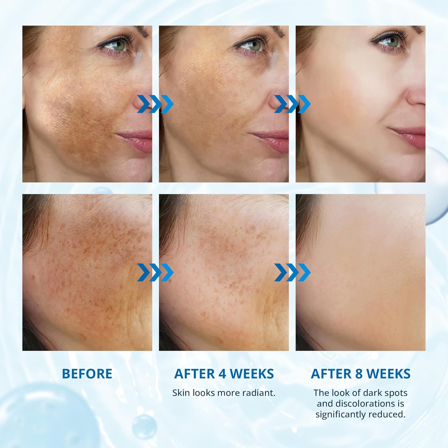 Abera Dark Spot Serum - Brighten Skin Fast - ABERA SHOP