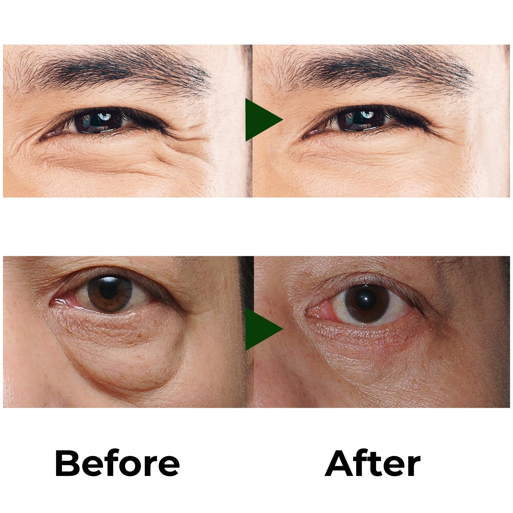 Abera Eye Roller Serum - ABERA SHOP