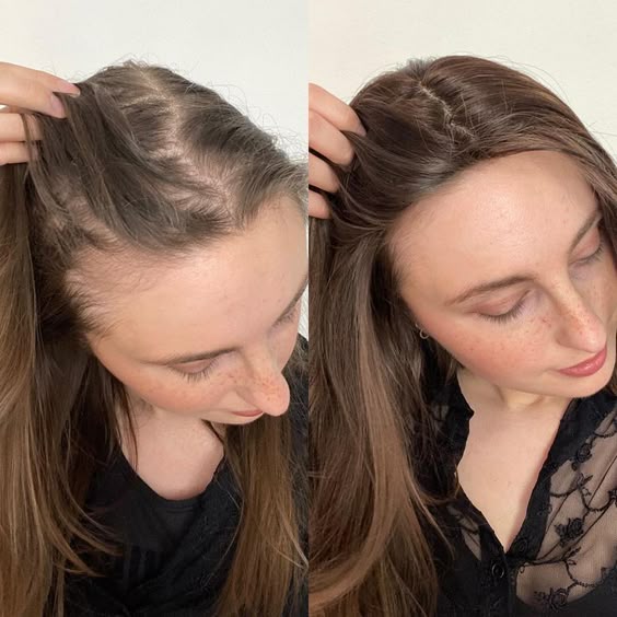 Abera Hair Growth Serum - ABERA SHOP