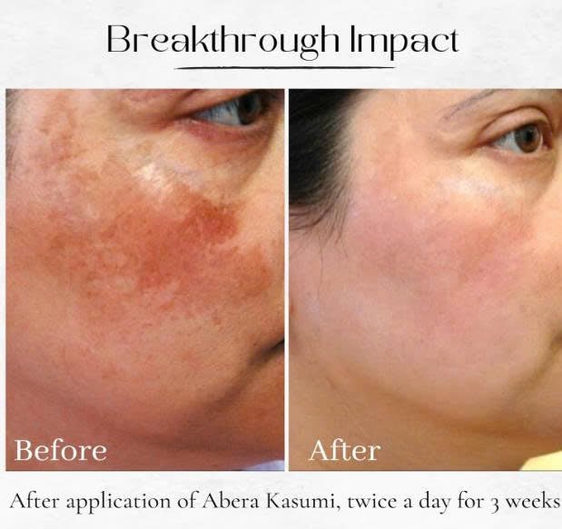 ABERA Kasumi Glowing Cream - ABERA SHOP