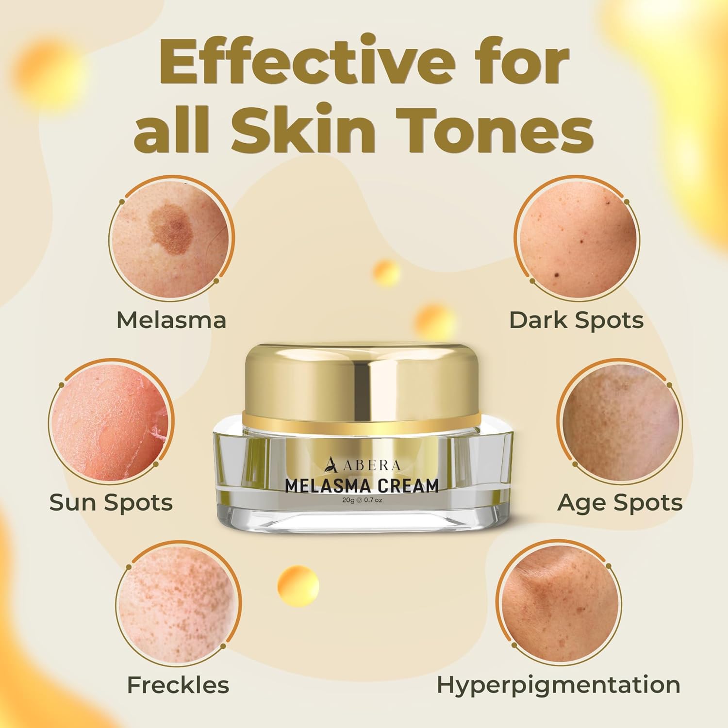 ABERA Melasma Cream - ABERA SHOP