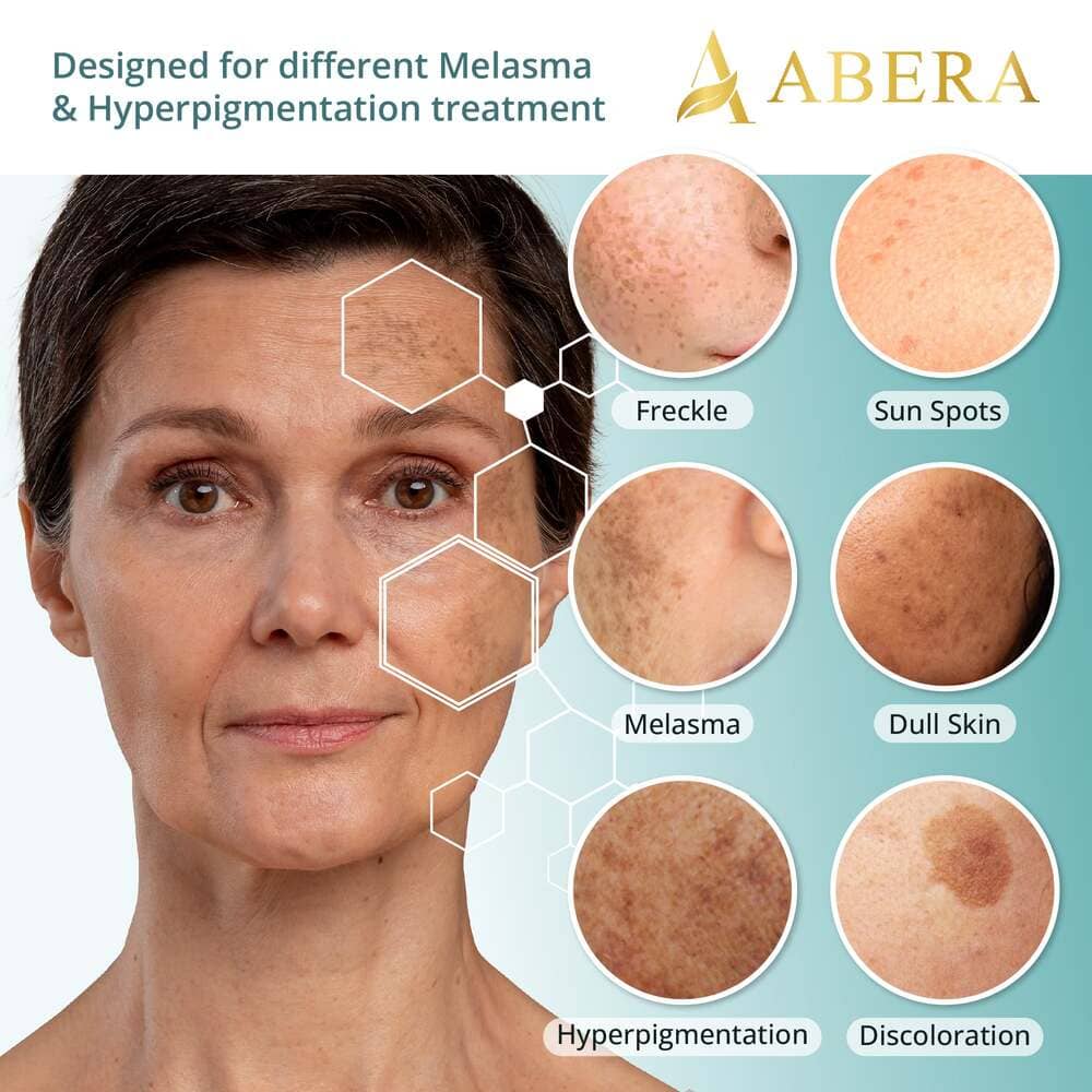 Abera Melasma Serum - ABERA SHOP