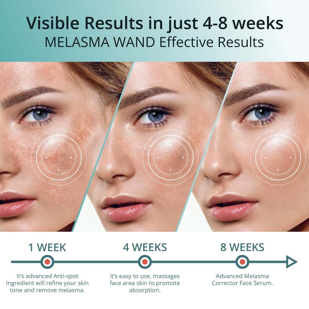 Abera Melasma Serum - ABERA SHOP