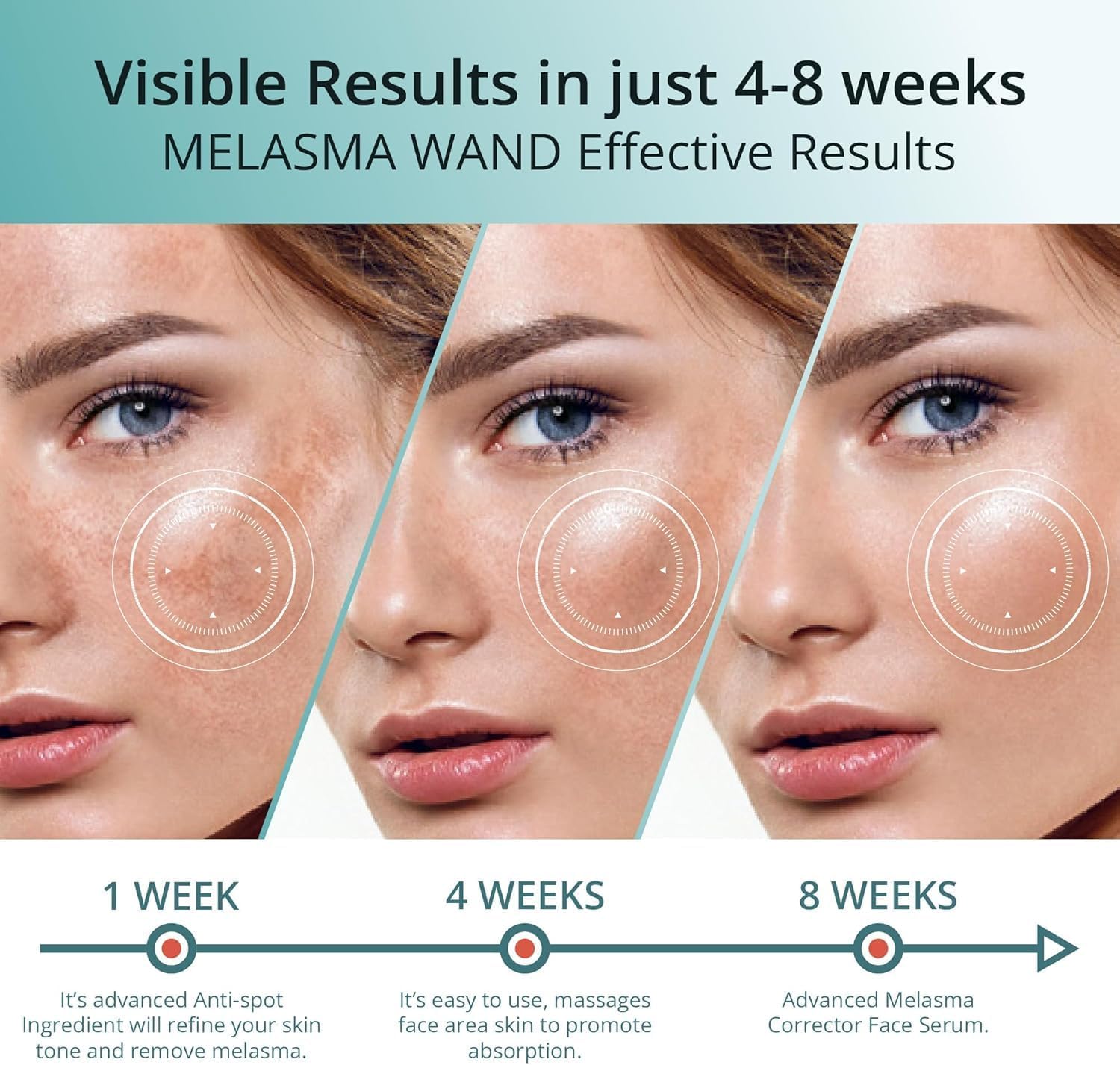Abera Melasma Serum, Melasma Treatment for Face, Dark Spot Corrector Serum, Melasma Dark Spot Remover, Sun Spot, Age Spot, Brown Spot Remover for Men, Women - ABERA SHOP