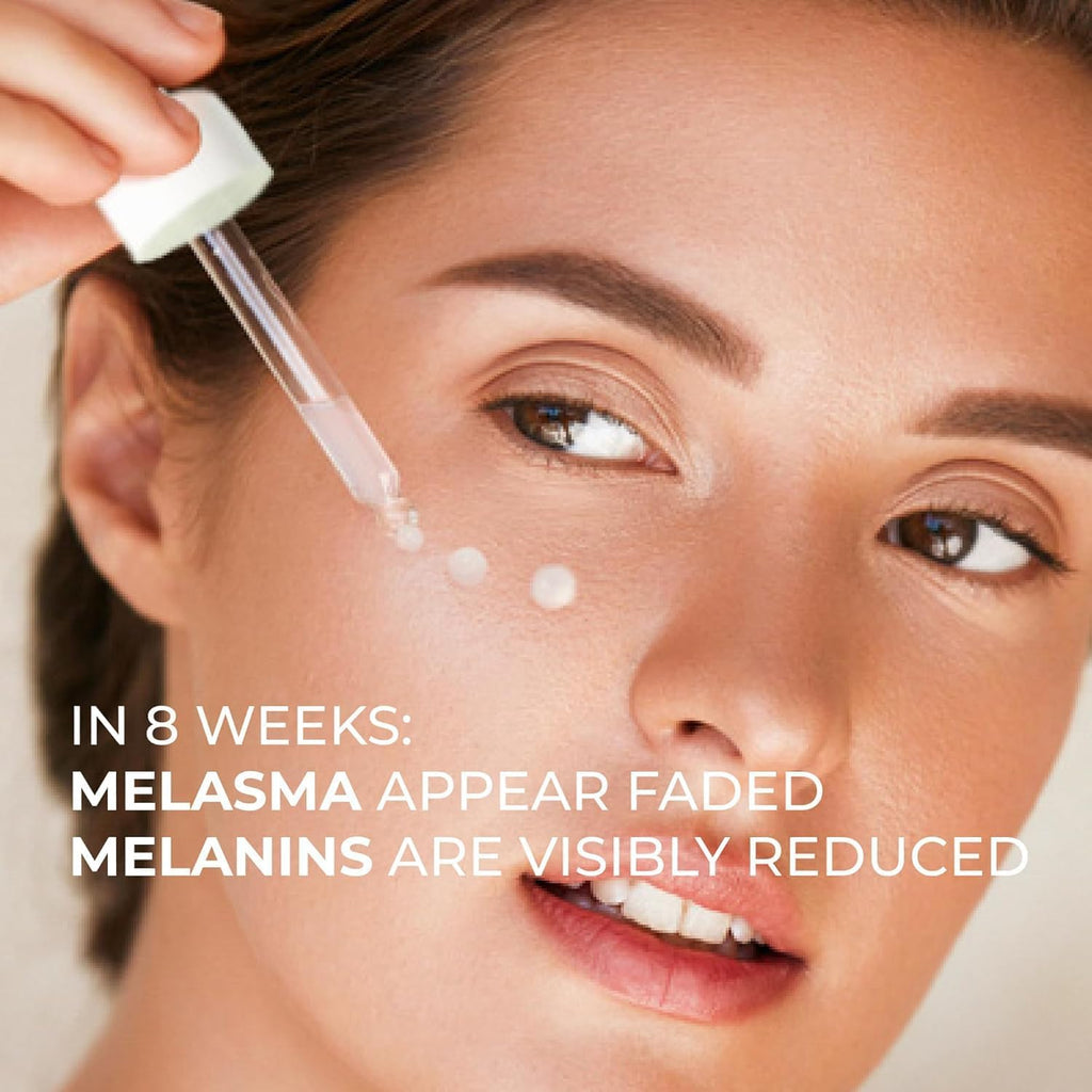 Abera Melasma Serum, Melasma Treatment for Face, Dark Spot Corrector Serum, Melasma Dark Spot Remover, Sun Spot, Age Spot, Brown Spot Remover for Men, Women - ABERA SHOP