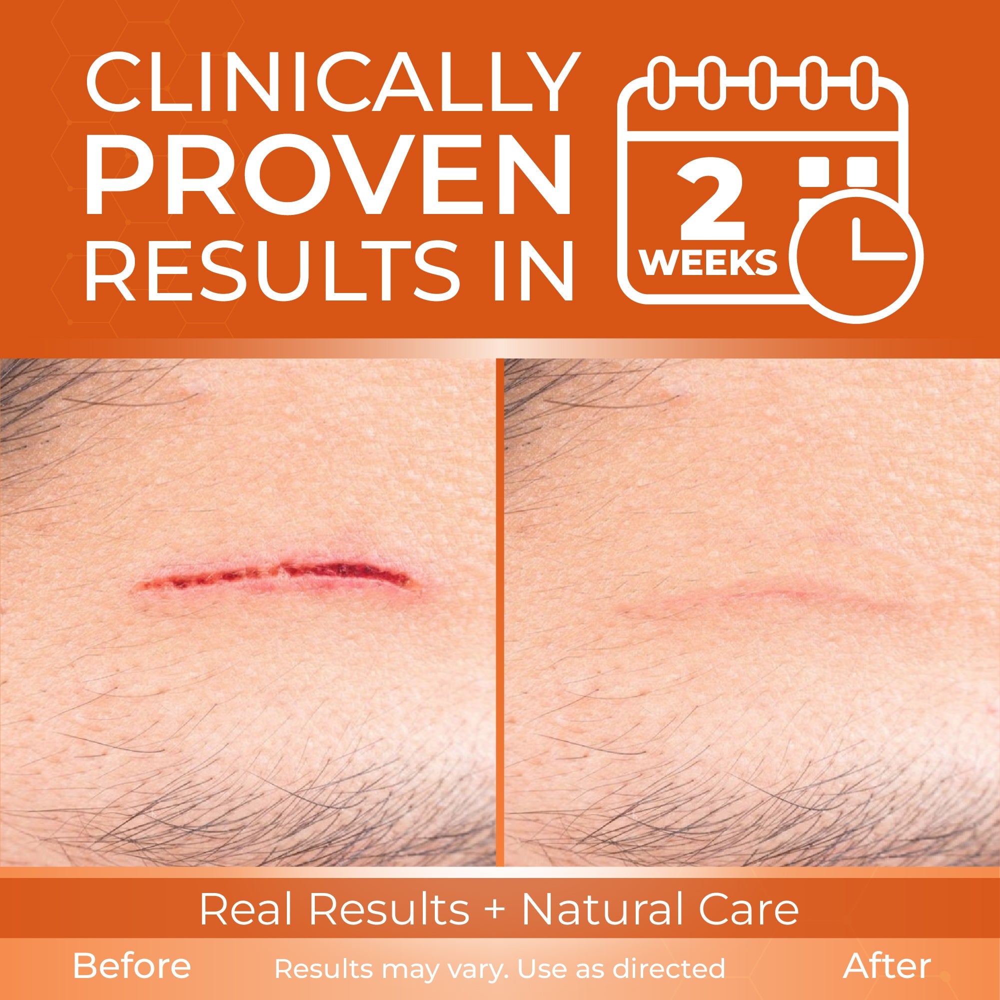Abera Scar Cream - A solution for all types of scars - ABERA SHOP