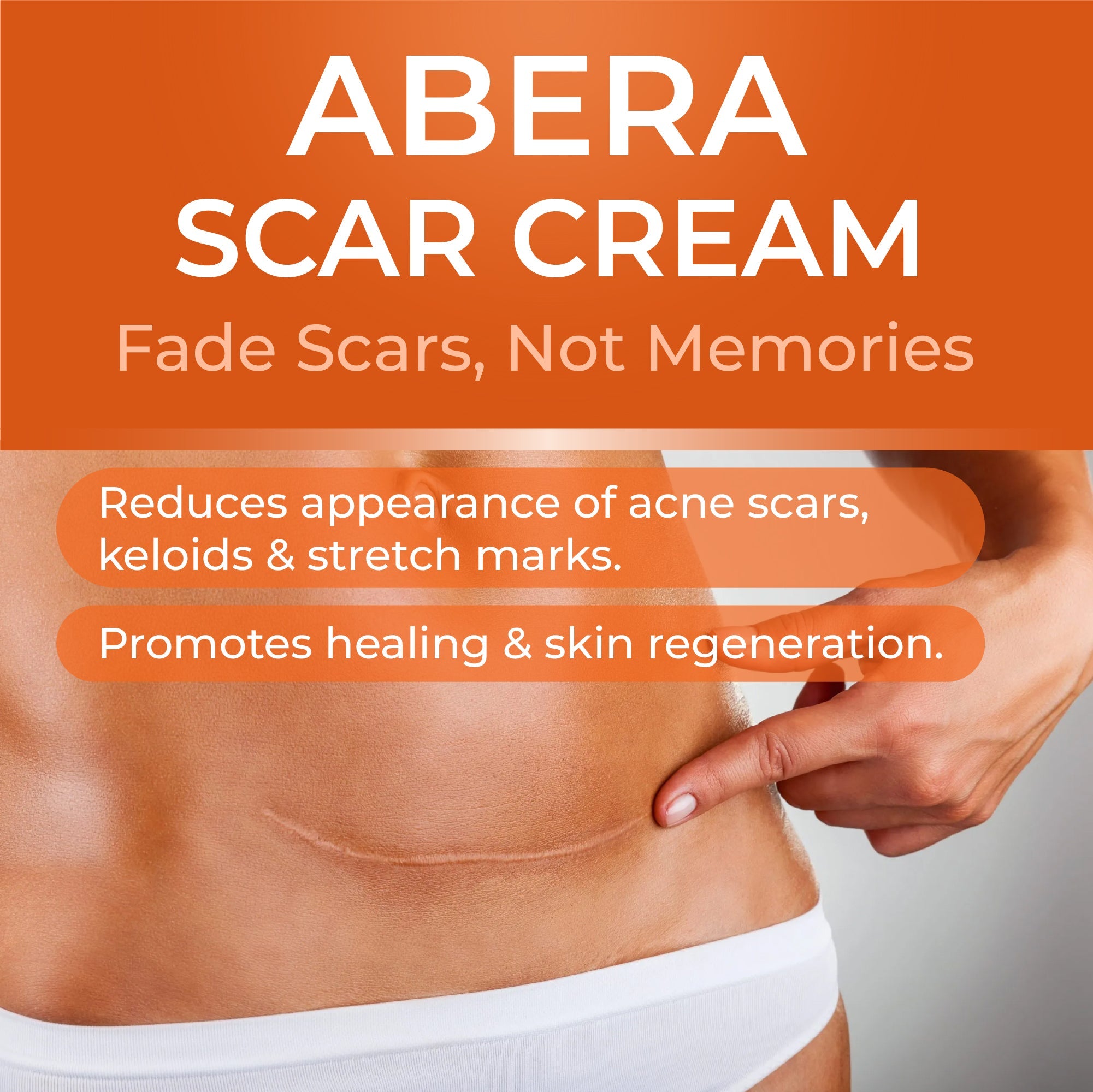 Abera Scar Cream - A solution for all types of scars - ABERA SHOP